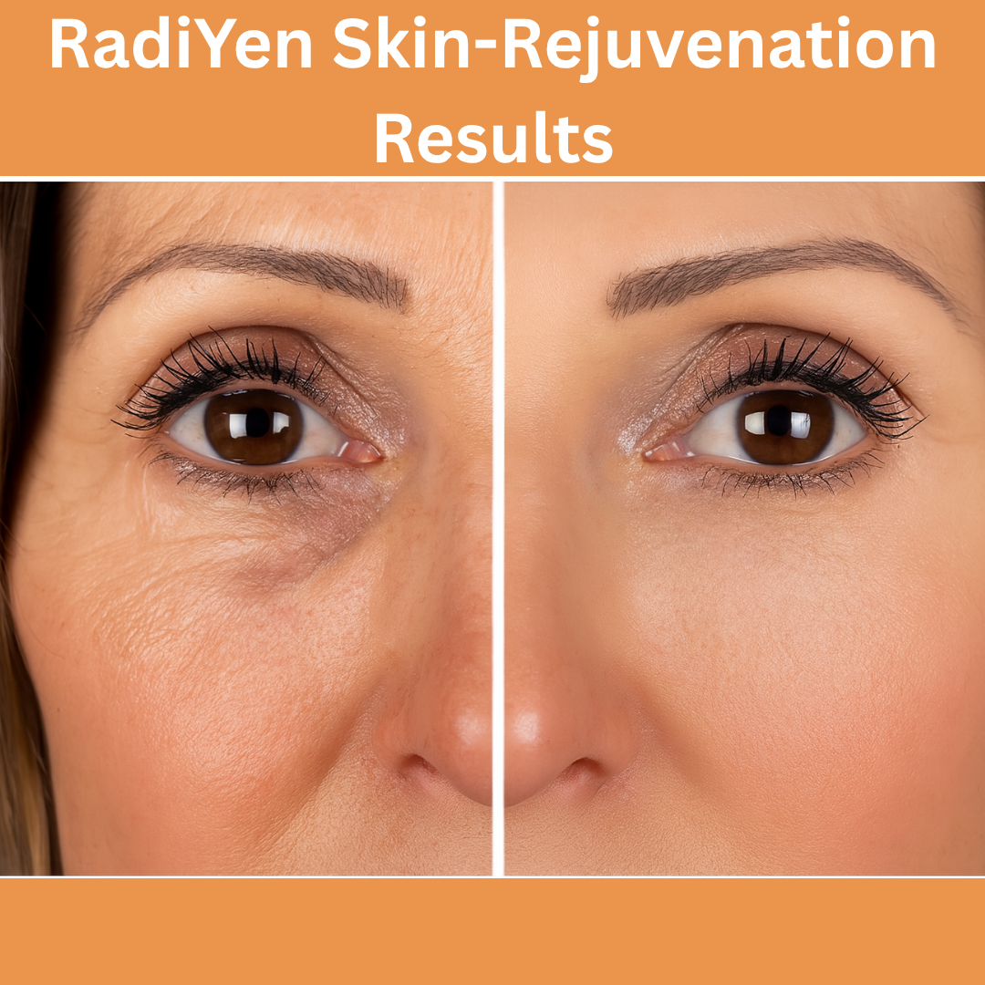 RadiYen High Frequency Wand