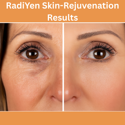 RadiYen High Frequency Wand