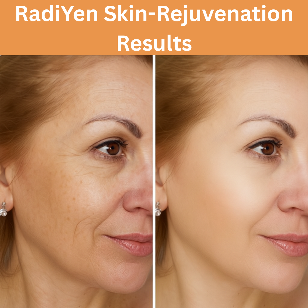 RadiYen High Frequency Wand