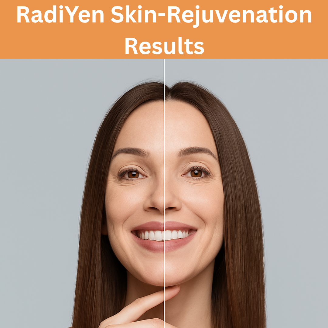 RadiYen High Frequency Wand