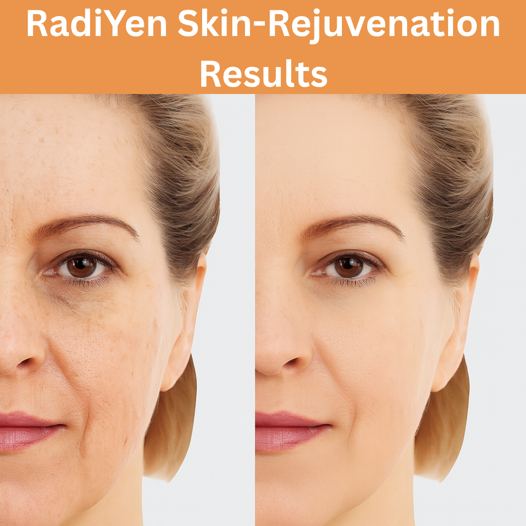 RadiYen High Frequency Wand