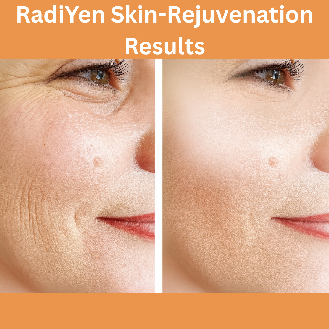 RadiYen High Frequency Wand