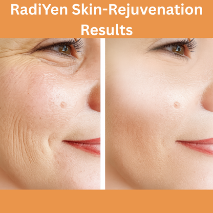 RadiYen High Frequency Wand