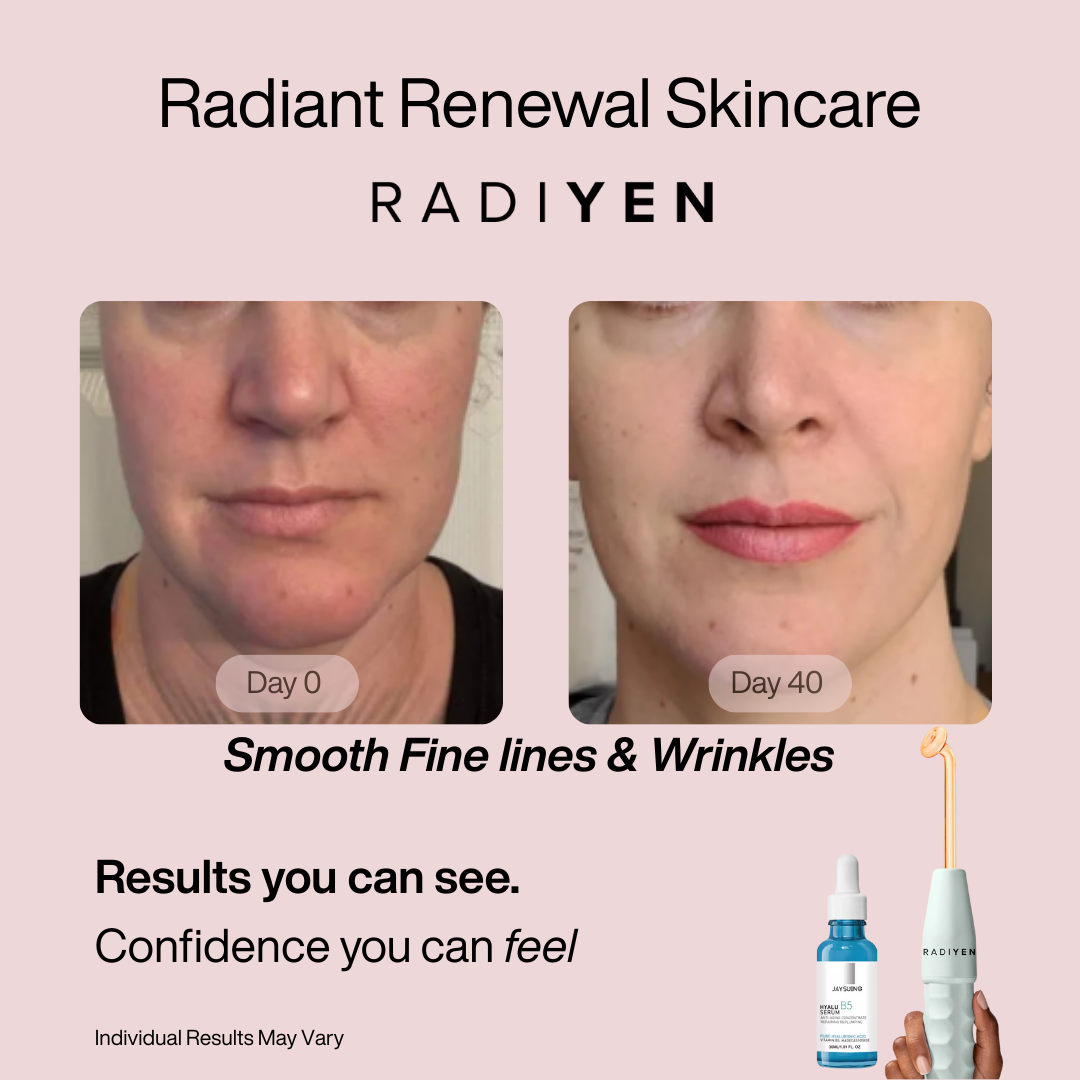 4-in-1 High Frequency Wand & Activating Serum Kit